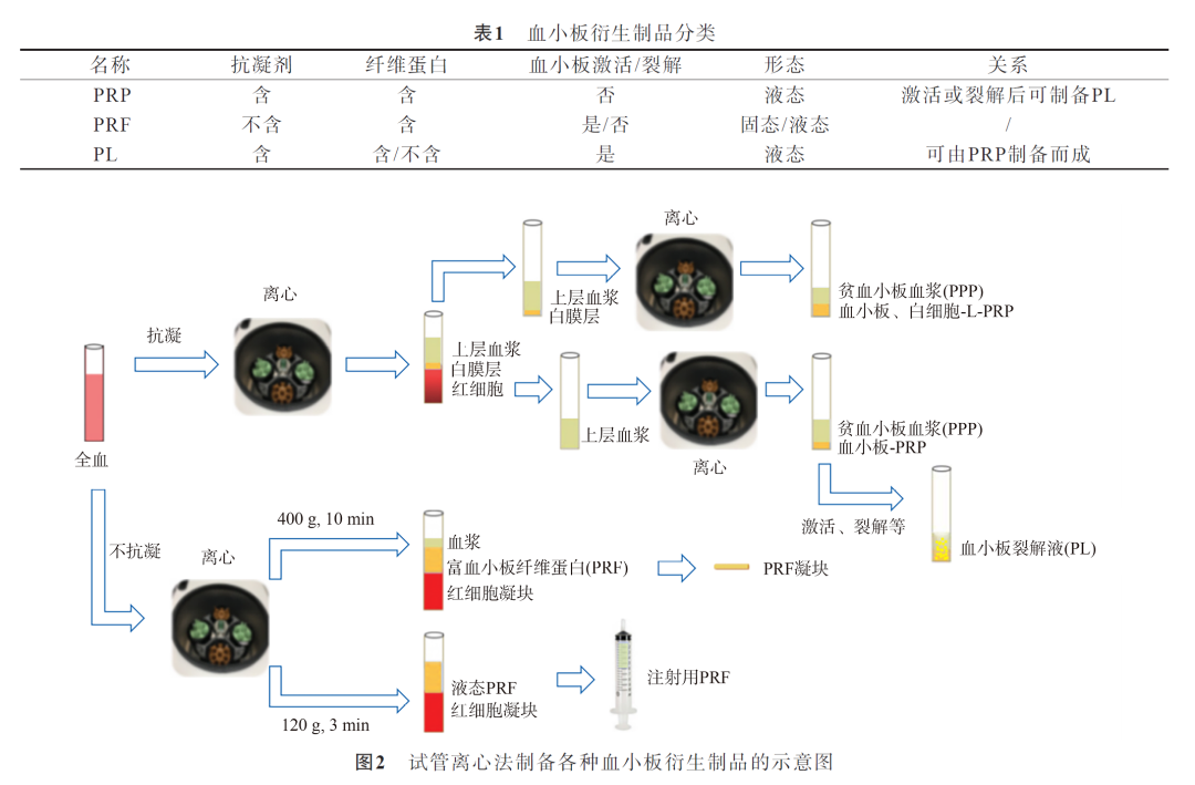 【PRP文献快递】自体富血小板浓缩物在妇科领域应用进展